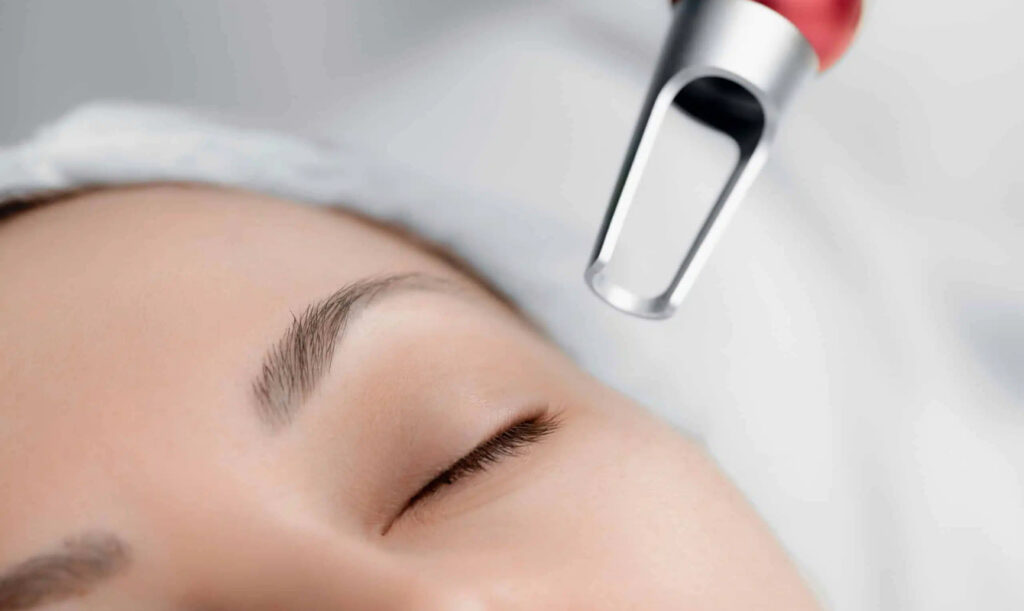 Is Laser Pigmentation Care Suitable For Sensitive Skin Types?